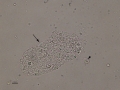 Wide granular cast