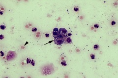 Urine cells
