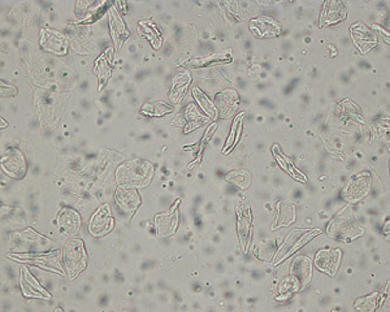 Squamous epithelial cells