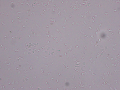 Neutrophils (activated)
