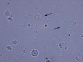 Neutrophils (activated)