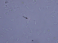 Neutrophils (activated)