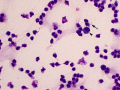 Neutrophils (activated)