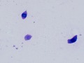 Renal tubular epithelial cells (Wright