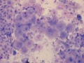 Urothelial cells (Wright's)