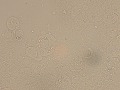 Urothelial cells