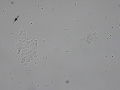 Urothelial carcinoma (cat)