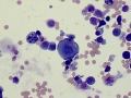 Urothelial carcinoma (Wright's, cat)