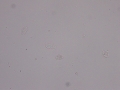 Squamous epithelial cells