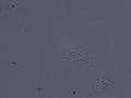 Squamous epithelial cells