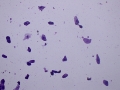 Squamous epithelial cells (Wright
