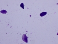 Squamous epithelial cells (Wright