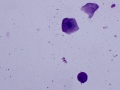 Squamous epithelial cells (Wright