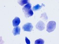 Squamous epithelial cells (Wright