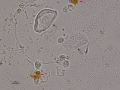 Inflammation & bacteria