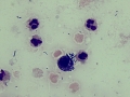 Inflammation & bacteria (Wright's)