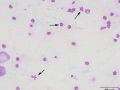 Dysmorphic red blood cells (line smear)