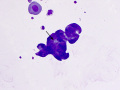 Neutrophil emperipolesis (Wright's)