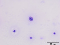 Dying epithelial cells (Wright