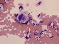 Erythrophage (Wright