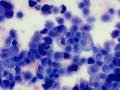 Urothelial carcinoma (Wrights, cat)