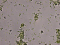 Hemoglobin globules