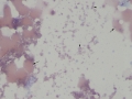 Hemoglobin globules (Wright