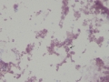 Hemoglobin globules (Wright
