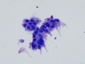 Prostatic epithelial cells (Wright