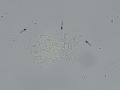 Prostatic epithelial cells