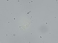 Prostatic epithelial cells