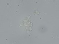 Prostatic epithelial cells