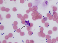 Bacteria & yeast (Wright's)