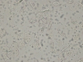Squamous epithelial cells