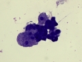 Transitional cells (Wright
