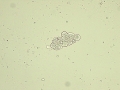 Transitional cells