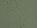 Transitional cells