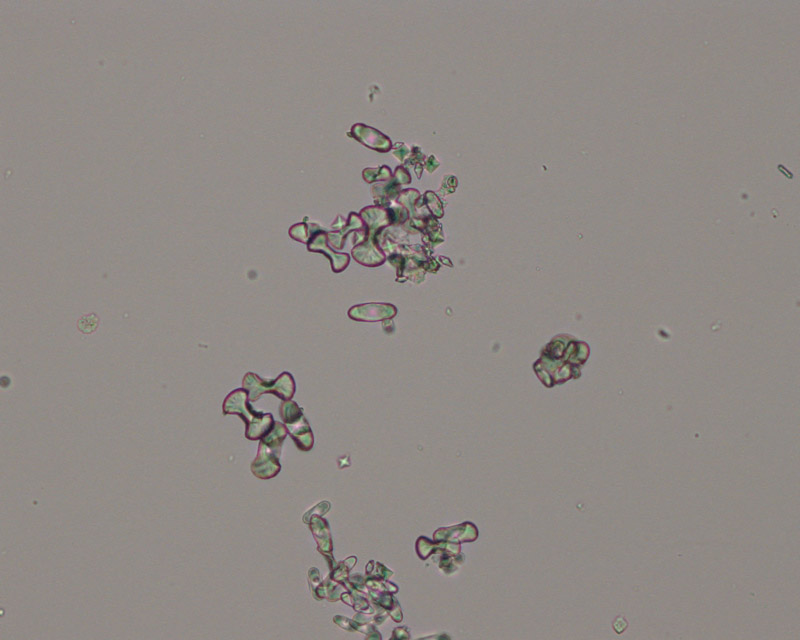 Растворение струвитов. Кристаллы оксалата кальция микроскопия. Струвиты микроскопия. Струвиты и оксалаты.