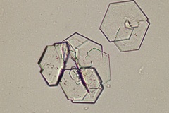Urine crystals