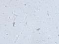 Ammonium biurate