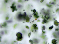 Ammonium biurate