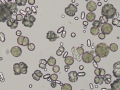 Calcium carbonate and oxalate