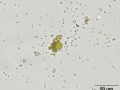 Xanthine