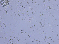 Ammonium biurate
