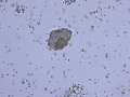 Ammonium biurate