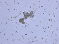 Ammonium biurate