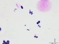 Ammonium biurate (Wright