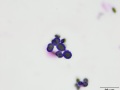 Ammonium biurate (Wright