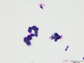 Ammonium biurate (Wright