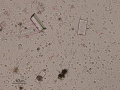 Ammonium biurate & struvite